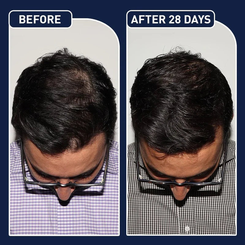 FEG PLUS - Hair Growth Spray