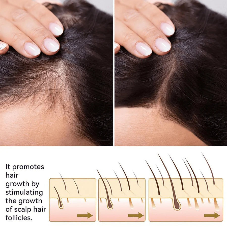FEG PLUS - Hair Growth Spray