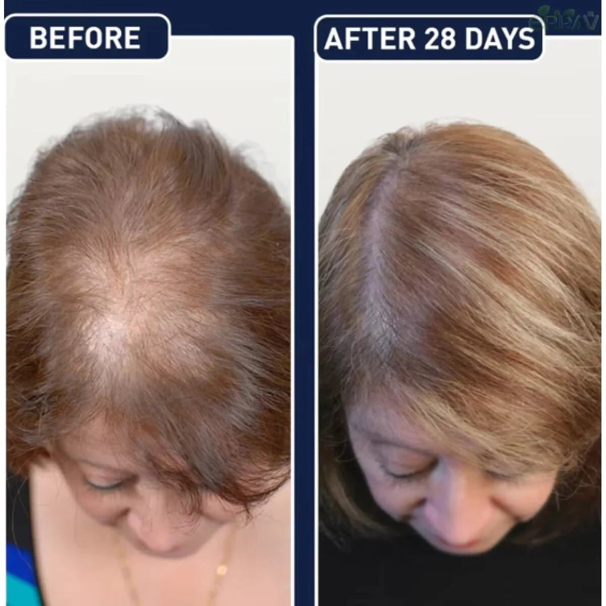 FEG PLUS - Hair Growth Spray