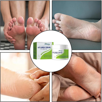 South Moon 42% Urea Cream | Intensive Foot & Body Moisturizer for Dry, Cracked Heels, Hands & Rough Skin