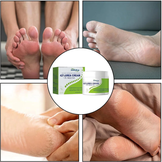 South Moon 42% Urea Cream | Intensive Foot & Body Moisturizer for Dry, Cracked Heels, Hands & Rough Skin