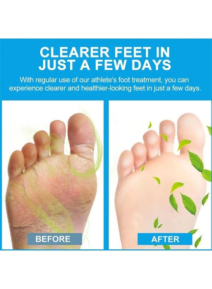 Sumifun Foot Anti-Bacterial Cream | Antifungal Foot Cream for Athlete's Foot, Itching, Odor & Dry Cracked Feet