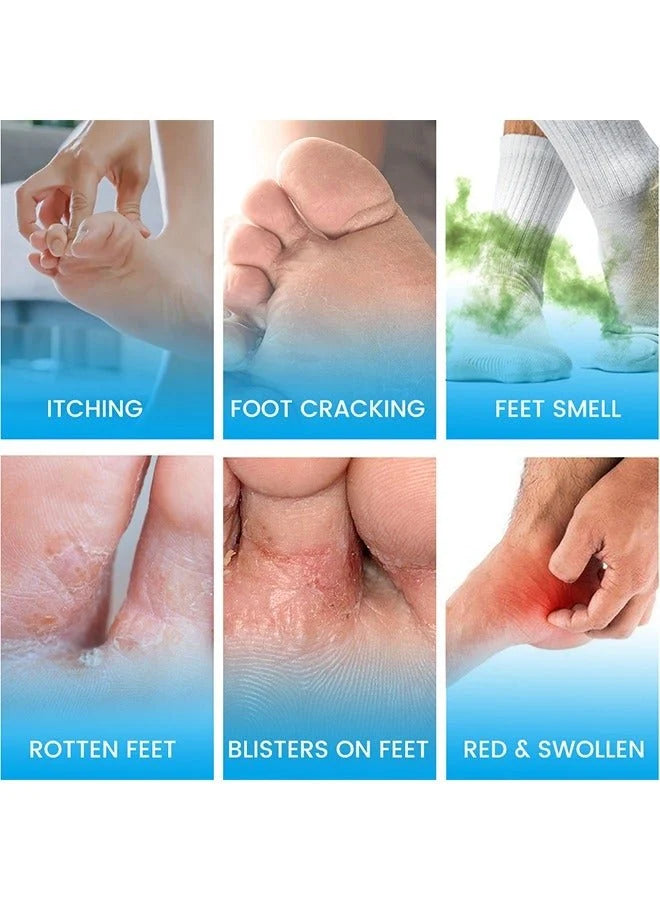 Sumifun Foot Anti-Bacterial Cream | Antifungal Foot Cream for Athlete's Foot, Itching, Odor & Dry Cracked Feet