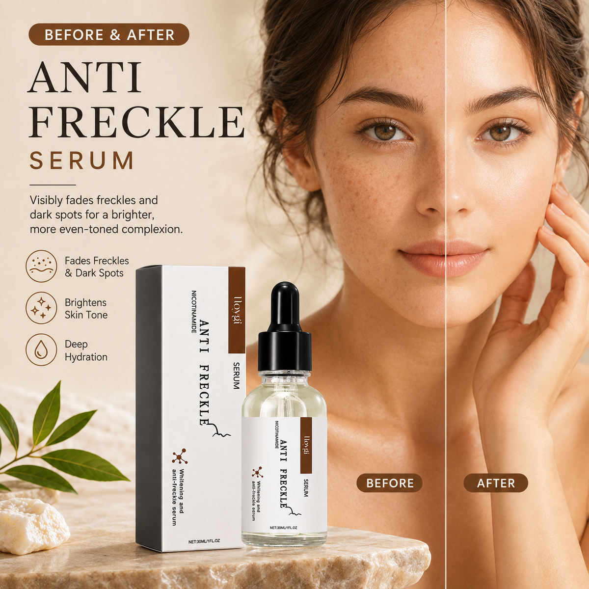 Anti Freckle Serum for Dark Spots & Pigmentation – Brightening Niacinamide Face Serum 30ml
