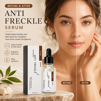 Anti Freckle Serum for Dark Spots & Pigmentation – Brightening Niacinamide Face Serum 30ml