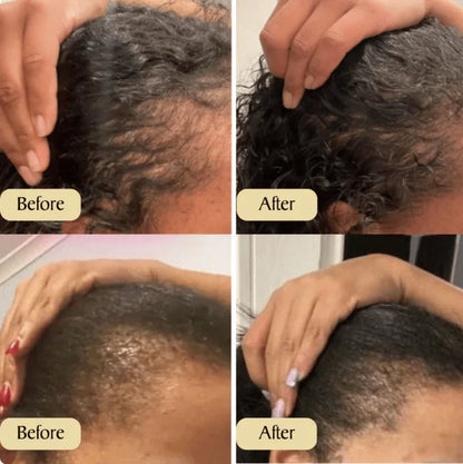 Hair Growth Oil for Men & Women | Natural Scalp Treatment for Thicker, Stronger & Healthier Hair | Nourishing Hair Regrowth Oil