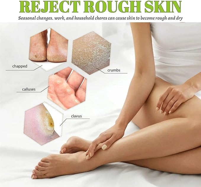 South Moon 42% Urea Cream | Intensive Foot & Body Moisturizer for Dry, Cracked Heels, Hands & Rough Skin
