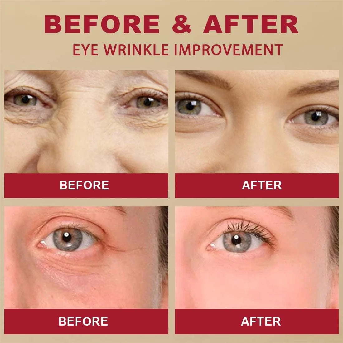 Seoul 1988 Eye Cream | Anti-Aging Korean Eye Cream for Dark Circles, Puffiness & Fine Lines | Hydrating Under Eye Treatment