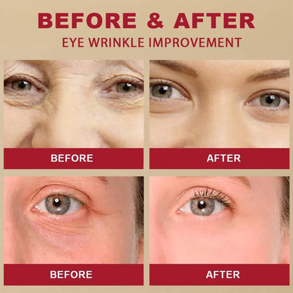 Seoul 1988 Eye Cream | Anti-Aging Korean Eye Cream for Dark Circles, Puffiness & Fine Lines | Hydrating Under Eye Treatment