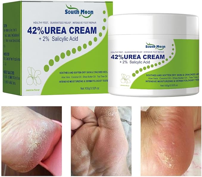 South Moon 42% Urea Cream | Intensive Foot & Body Moisturizer for Dry, Cracked Heels, Hands & Rough Skin