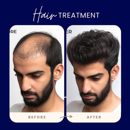 FEG PLUS - Hair Growth Spray